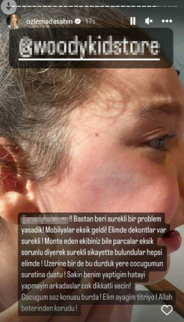 La porte de l'armoire est tombée sur le visage de la fille de Berkay Şahin