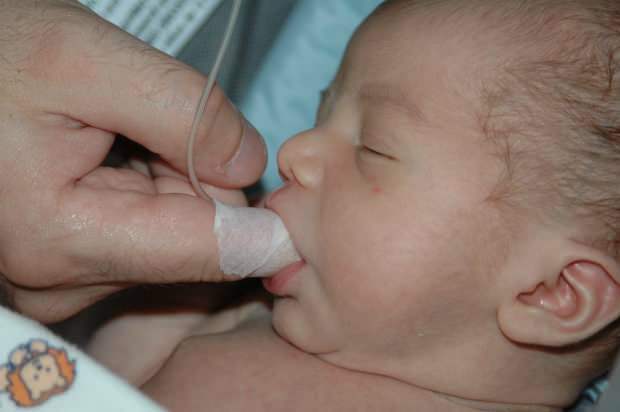 Quelle est la méthode d'alimentation au doigt? Comment nourrir le bébé avec une seringue?