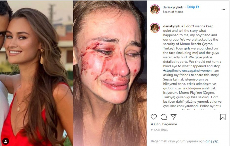 Daria Kyryliuk, le mannequin qui a été battue à Izmir Çeşme, a attrapé un coronavirus!
