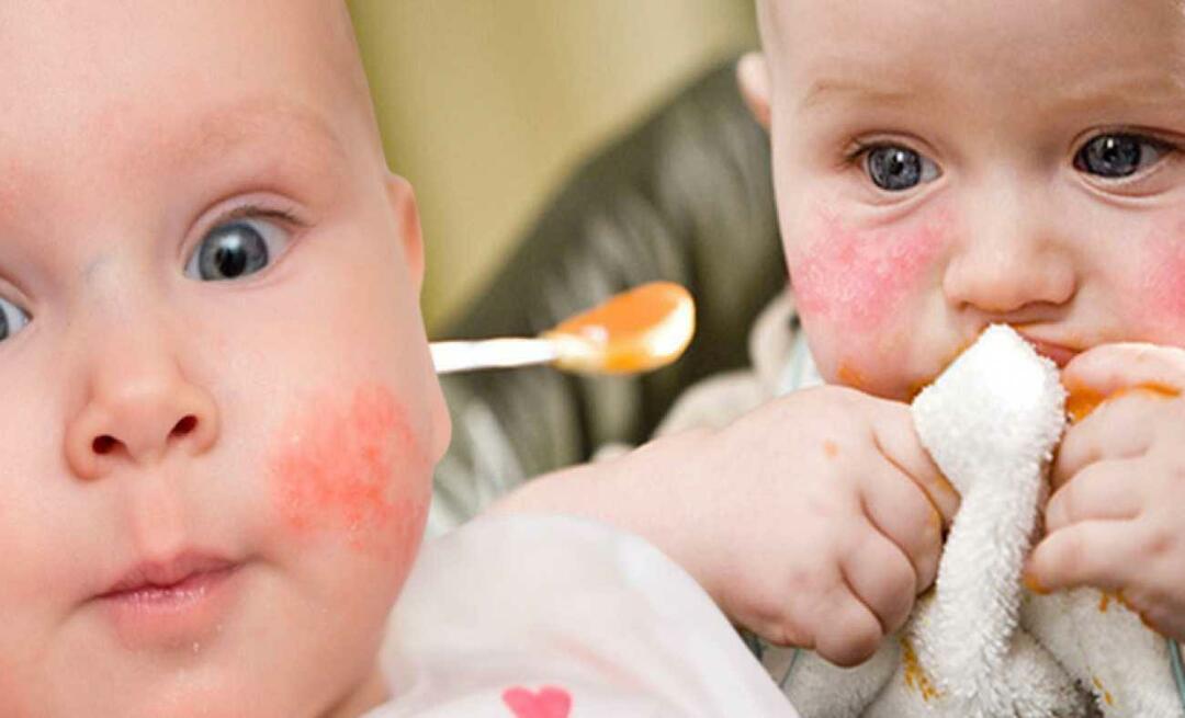 Que doit manger un bébé allergique? Quels sont les aliments alternatifs pour les bébés allergiques ?