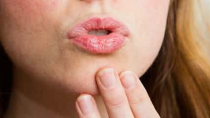 Comment faire un soin des lèvres à la maison? Soin facile des lèvres sèches en 4 étapes