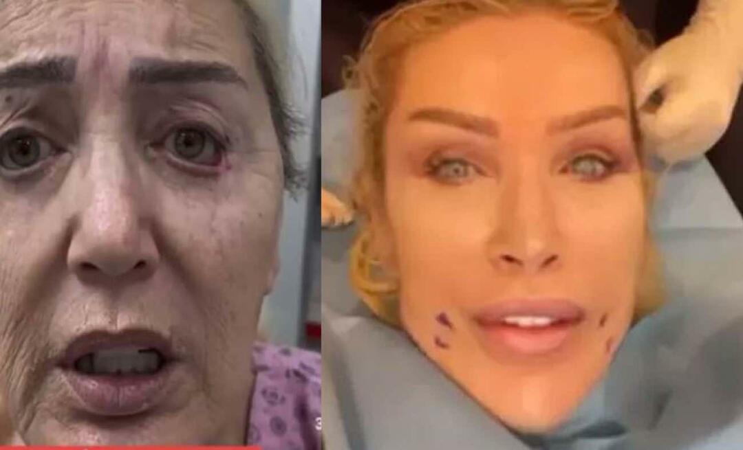 Nous a fait oublier la magnifique transformation de Mme Süreyya! La sœur aînée de Seda Sayan a officiellement subi une greffe du visage