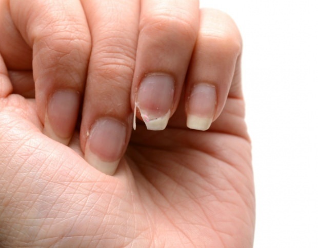 Comment se fait le soin des ongles? Méthodes d'extension rapide des ongles