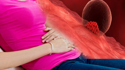 Qu'est-ce que l'implantation? Comment distinguer les saignements des saignements menstruels?